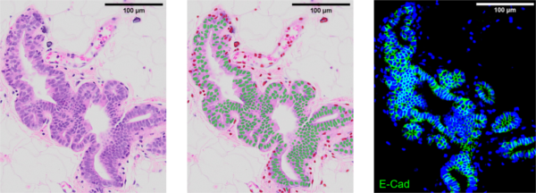 Classification de cellule